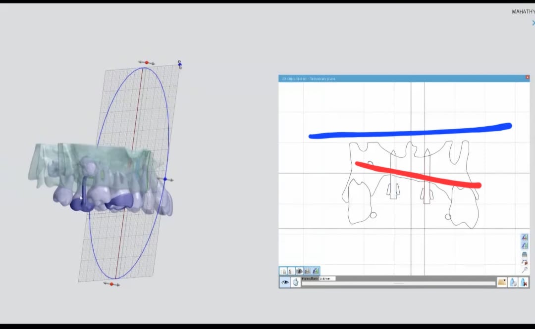 CAD MARPE 2